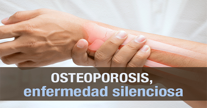 Osteoporosis, enfermedad silenciosa
